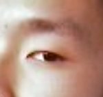 앞트임을하려는데요,(사진첨부!!)