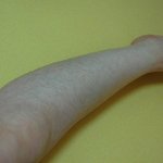여자인 저 . . 털이 너무 많아요 ㅠㅠ(사진有)