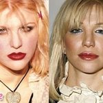 <b>헐리</b>웃스타의 성형전후 사진