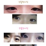 쌍수하나로 용됫어요 ㅎ
