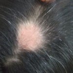 스카이폰쓰다가탈모생겨...