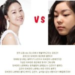 <b>피부</b>관리 좋은예 <b>vs</b> 나쁜예와 <b>피부</b>관리방법