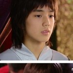 유승호, 치아 교정 전 <b>vs</b>  교정 후 비교