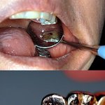 (사진 有) 충격!!치과 <b>의료</b> 과실! 너무 억울합니다.도와주세요...