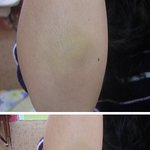 매맞는 20대 어떻게 생각하세요?