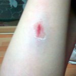 정류장에서 넘어졌습니다....(사진有)