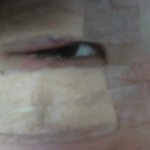 강아지한테 눈을 물렸어요 ㅠ