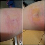 첫 <b>헌혈</b>!했어요