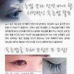 예쁜속눈썹보다 신경써야 할 치명적인 속눈썹 탈모!