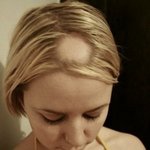 지금 당신의 여친은 탈모<b>일지</b>도 모른다!