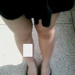 <b>남들</b>보다 2배는 굵은 다리 때문에 고민이에요 (사진有)