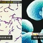 [영유아 건강정보] 2차감염 막아주는 폐렴구균 백신
