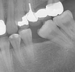 <b>의료</b>사고-조언부탁드려요(사진유)