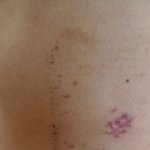 호주에서 <b>칼로</b> 찔렸어요...음료수대신 칼침 놔주네요 인증샷