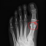 <b>신검</b>받던날..