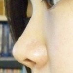 내 <b>코</b>좀 봐주세요