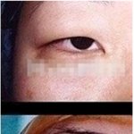 쌍수할<b>분만</b>/ 사진有 /