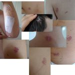 강도가 칼로 찔렀습니다.