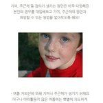 <b>기미</b> 생기기 쉬운 여름, 피부관리하자!