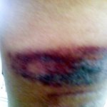 [사진有]대한민국 선생님의 심한 <b>체벌</b>을 신고합니다!