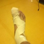 다가오는 월드컵과 바꾼 나의 발톱....(사진 有)