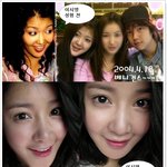<b>서우</b> 이시영 알고 보니 같은 곳에서 성형했네??