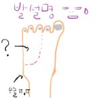 <b>복숭아뼈</b>수술후 감각이 이상합니다~