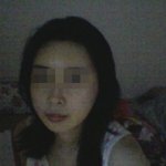 [안면윤곽,양악수술 성공일기] 내나이 서른다섯, 꿈은 이루어진다★