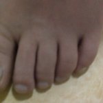 같이자취하는녀석한테 옮은 <b>무좀</b>..<b>무좀</b>없애는크림까지 사용중.