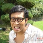 치아기능 <b>미달</b> 군면제 mc몽, 과거 치아사진