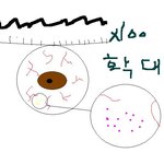 안과에서 개드립친 사건 ㅜ