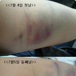 <b>헌혈</b>,,좋은일하러갓다가 이게 뭐냐며...-_-
