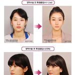 의사가 <b>응급</b>환자만 살리는게 아니랑께