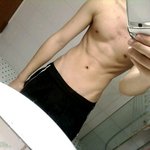 볼품없는남자 없는<b>치골</b> 만드느라 힘들엇음 어때요