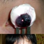 ◈ <b>포크</b>로 눈을 쑤셔봤어요 ⊙.⊙  ◈