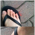 사진有)<b>발가락</b>이 이상해요