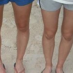 사진有) 사진추가요 굵은다리.... 어떡하죠