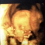 24주된우리 <b>미르</b> ♡