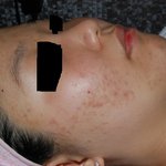 개과천선 내 피부