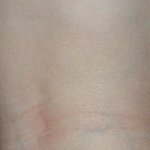 내 오른쪽 종아리 이거슨 뭣이다요