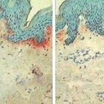 평범한 일상, 하루 종일 열에 노출되어 노화되는 내 피부!