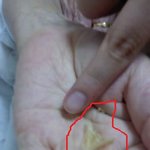 할머니 귀지를 팟는데 <b>눈깔</b>만한 귀지가 나왓어요ㅠ 사진 有