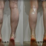 <b>종아리알</b> 있는 여자로 산다는건 참...