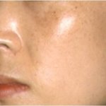 출산으로 <b>기미</b>가 생긴 제 삶의 활력소~^^ 화이트 프로젝트~!!