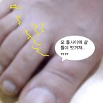 <b>무좀</b>에걸린 청년ㅠㅠ무좀크림후기를 쓸게요!참고하세요..