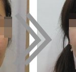 수술없이 젊어지는 제 피부 자랑질~