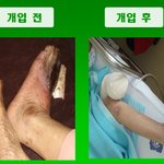 눈에 보이는 상처라도 <b>치유</b>해 주세요.