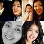 (사진有) 치아교정이 너무하고싶었던 나