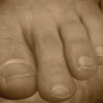 피부상태도 안좋은데 <b>무좀</b>까지,,<b>무좀</b>크림을 사용해봤습니다