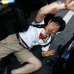 신장결석 걸린 나를 끌어낸 할아버지.
